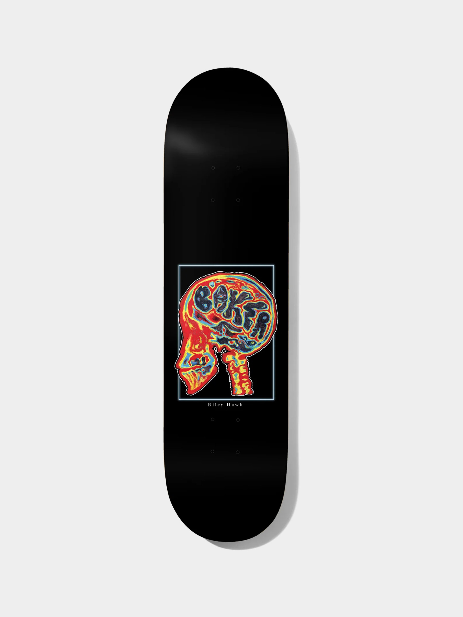 Baker Deck RH Brain Donor