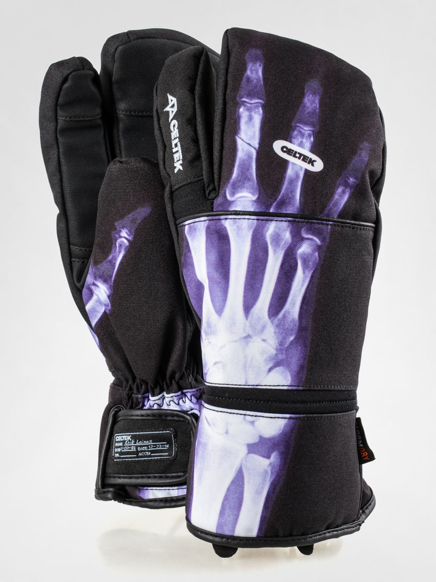Celtek Gloves Trippin (x ray)